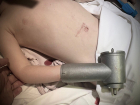 Ребенок засунул руку в мясорубку в Воронежской области