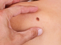 Воронежские врачи рассказали, каким онкозаболеваниям больше всего подвержены жители региона