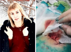 Прооперированную женщину выписали из Борисоглебской РБ с дыркой в животе