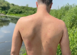 Как спастись от «зуда купальщика», рассказали специалисты