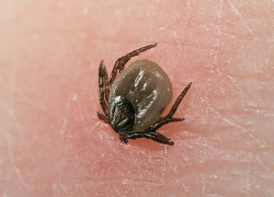 Жители Воронежской области стали реже обращаться к врачам из-за клещей