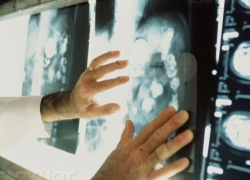 В Воронежской области выявлено 65 тыс. человек, больных раком