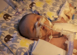 В Воронежской области ежегодно выявляют свыше 250 детей с врожденными пороками сердца