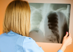 Жители Воронежской области смогут получить консультацию по профилактике туберкулёза