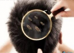 В Воронежской области за полгода 230 человек переболели вшивостью