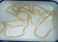 У жителя Воронежской области обнаружили бычий цепень