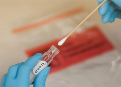 Жителей Воронежской области будут тестировать на COVID-19 перед плановой госпитализацией