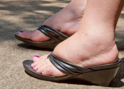 Борисоглебцам на заметку. Почему к вечеру отекают ноги