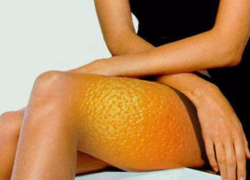 Женские советы: действенный способ победить целлюлит