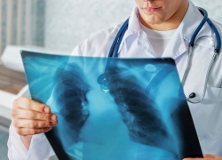 Жительница Борисоглебска, заразившаяся туберкулёзом на работе, получит 500 тыс. рублей компенсации 