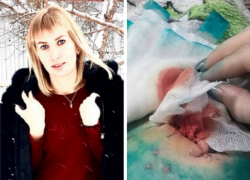 Прооперированную женщину выписали из Борисоглебской РБ с дыркой в животе