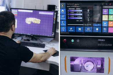 Лечение, удаление, протезирование зубов в стоматологии "Небо" - 