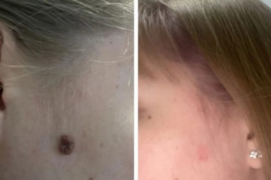 Врач-дерматовенеролог, врач-косметолог Кудренко Т.Н. - 